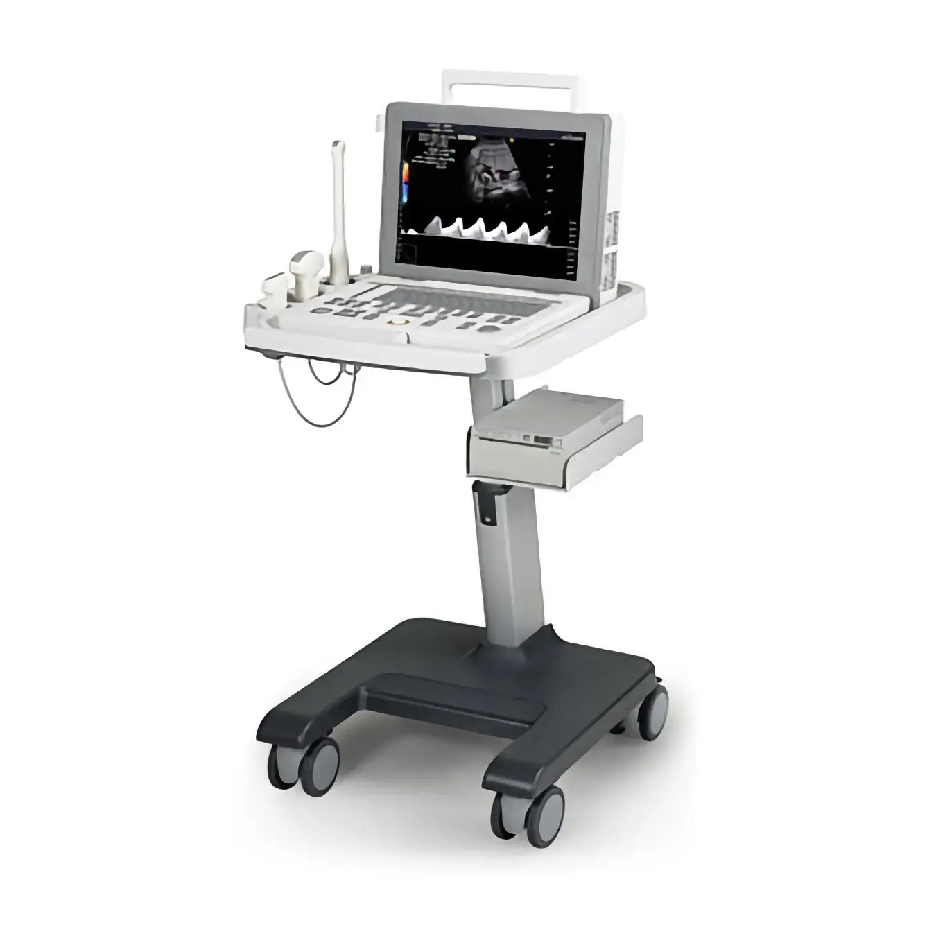 Ультразвуковой сканер Samsung Medison SonoAce R3